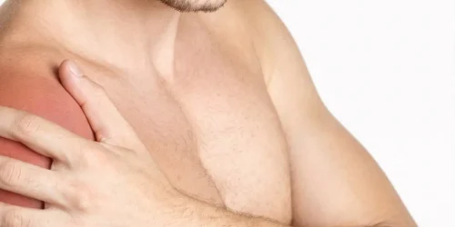 Naradaji-serv-Ondasdechoque-dolororigidezhombro-scd