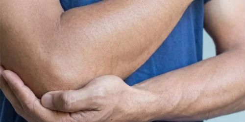 Naradaji-serv-Ondasdechoque-epicondilitisyepitrocleitis-scd
